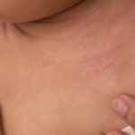 A close-up of a child's upper chest and neck shows a patch of red, irritated skin, highlighting potential health risks as someone gently pulls down the shirt collar to reveal the affected area.