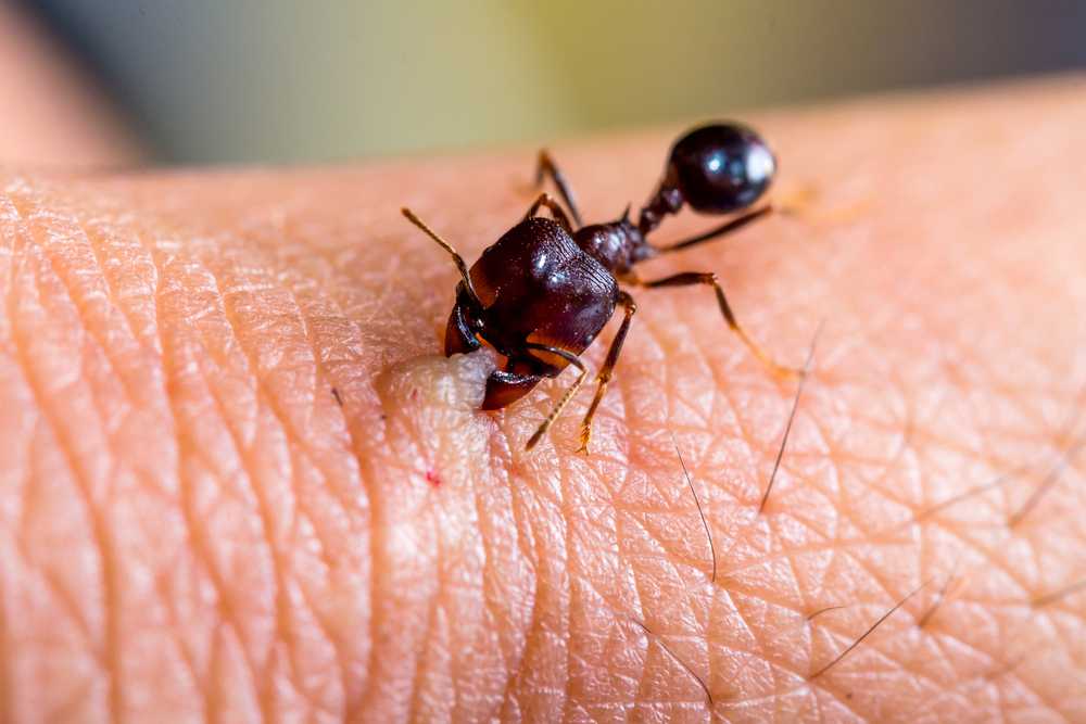 A close-up of a dark brown ant identified as one of the ants that bite, gripping human skin and causing a small raised bump and redness at the site on a person's hand.